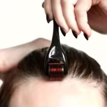 Hair Growth Therapy Derma Roller For Men And Women